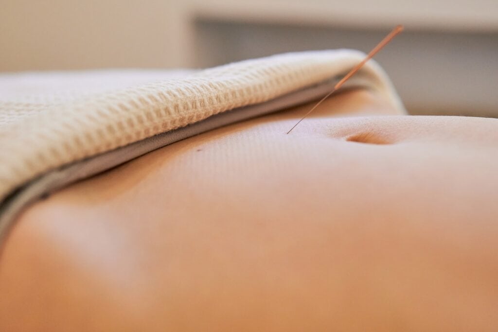 acupuncture grossesse Acupuncture grossesse: réponses aux questions fréquentes pendant cette période