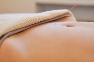 Clinique d'acupuncture à Montréal Accueil