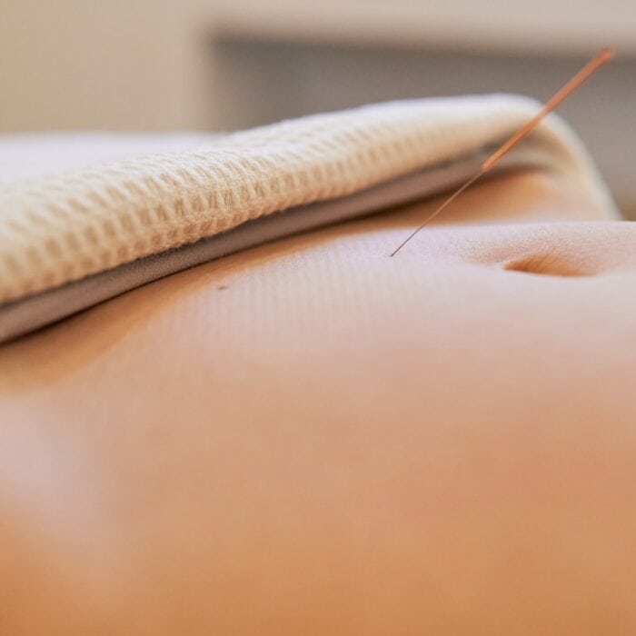 acupuncture fertilité​ Blogue